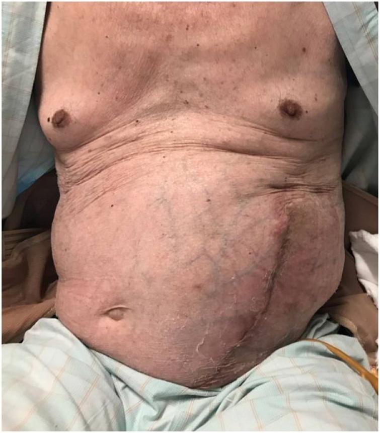 https://cdn.ncbi.nlm.nih.gov/pmc/blobs/151a/6260369/3073f5846248/gr5.jpg