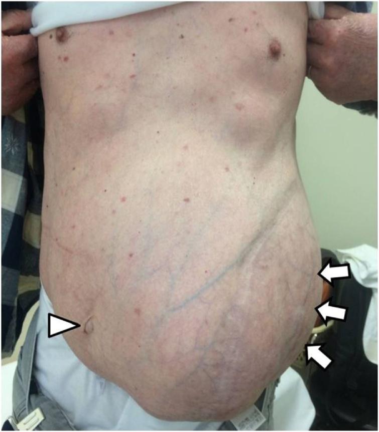 https://cdn.ncbi.nlm.nih.gov/pmc/blobs/151a/6260369/83c7c4b269b6/gr1.jpg