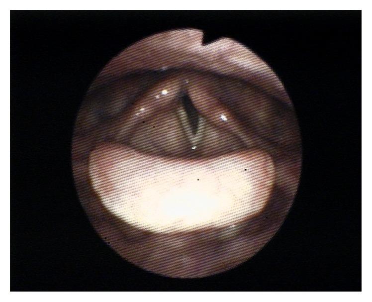 https://cdn.ncbi.nlm.nih.gov/pmc/blobs/1523/5149601/b8b4b40cb95e/CRIA2016-8185628.001.jpg