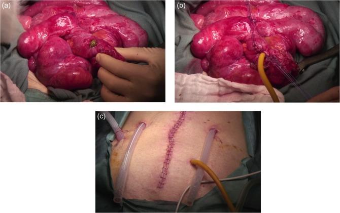 https://cdn.ncbi.nlm.nih.gov/pmc/blobs/1524/4866283/0a2a3795a9f4/rjw085f01.jpg
