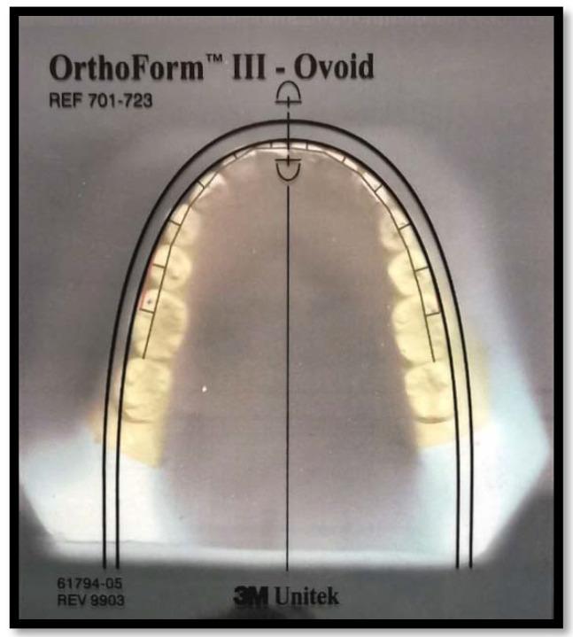 https://cdn.ncbi.nlm.nih.gov/pmc/blobs/1526/9600372/ce401fcf74a2/diagnostics-12-02352-g003.jpg