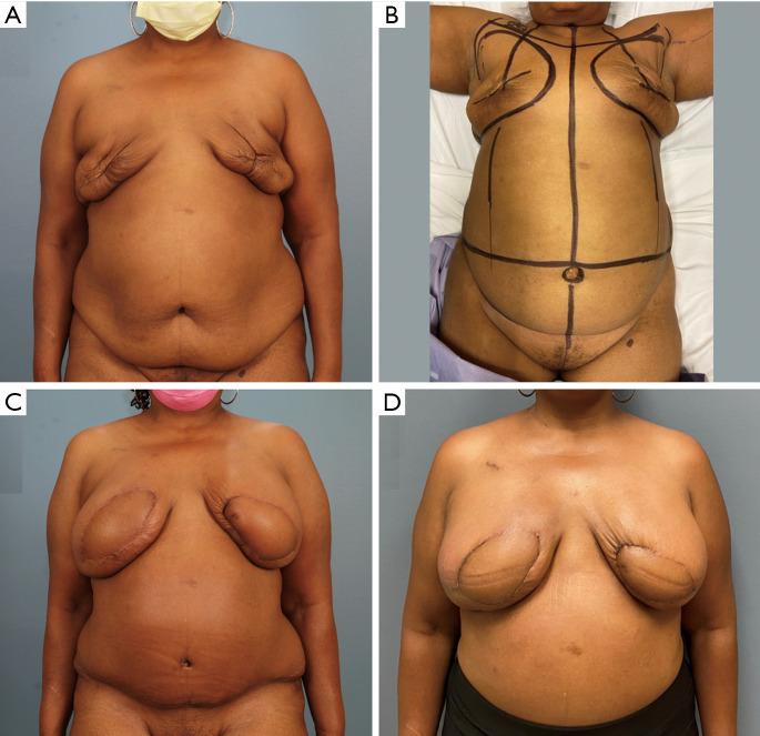 https://cdn.ncbi.nlm.nih.gov/pmc/blobs/1529/11399014/3a1d85c137bb/gs-13-08-1535-f1.jpg