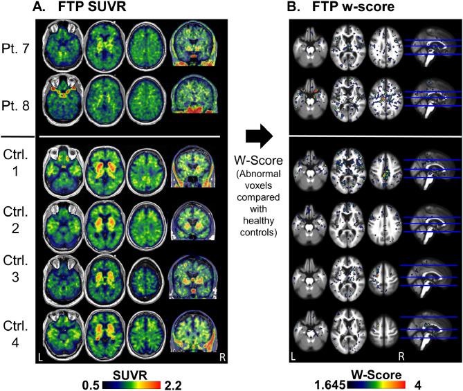 https://cdn.ncbi.nlm.nih.gov/pmc/blobs/152c/6831941/587bee4ffaef/gr2.jpg