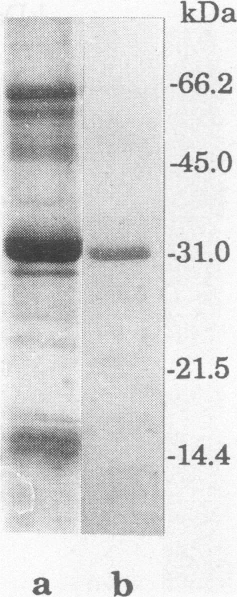 https://cdn.ncbi.nlm.nih.gov/pmc/blobs/152e/302826/22444c8bf617/iai00015-0186-a.jpg