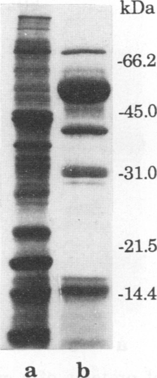 https://cdn.ncbi.nlm.nih.gov/pmc/blobs/152e/302826/57ffef56afc2/iai00015-0185-a.jpg