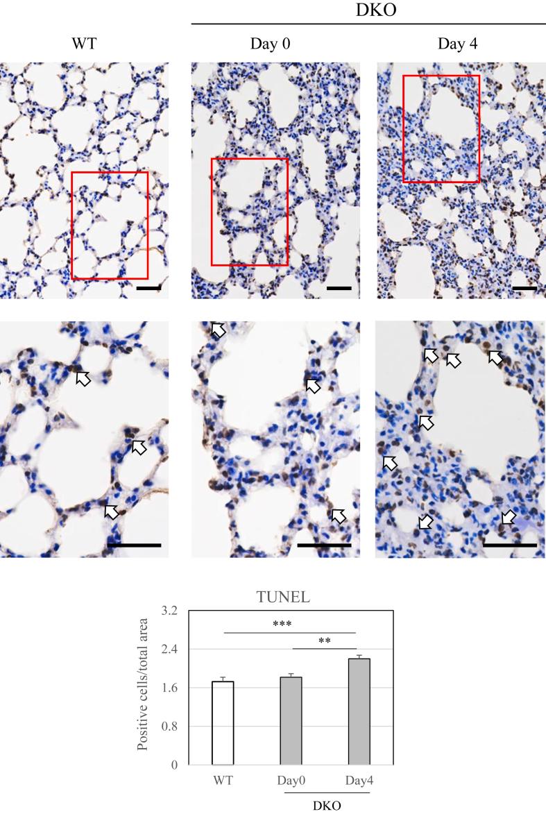 https://cdn.ncbi.nlm.nih.gov/pmc/blobs/1538/12273234/d6a8544ed368/gr2.jpg