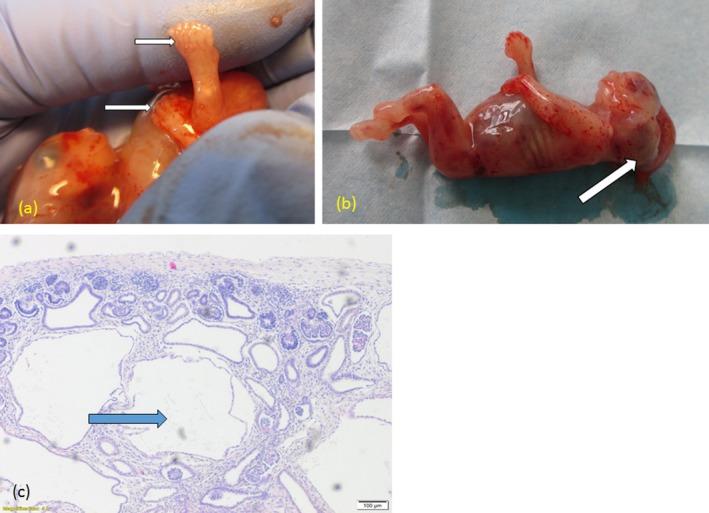 https://cdn.ncbi.nlm.nih.gov/pmc/blobs/1545/6503012/022adb48143c/MGG3-7-e614-g002.jpg