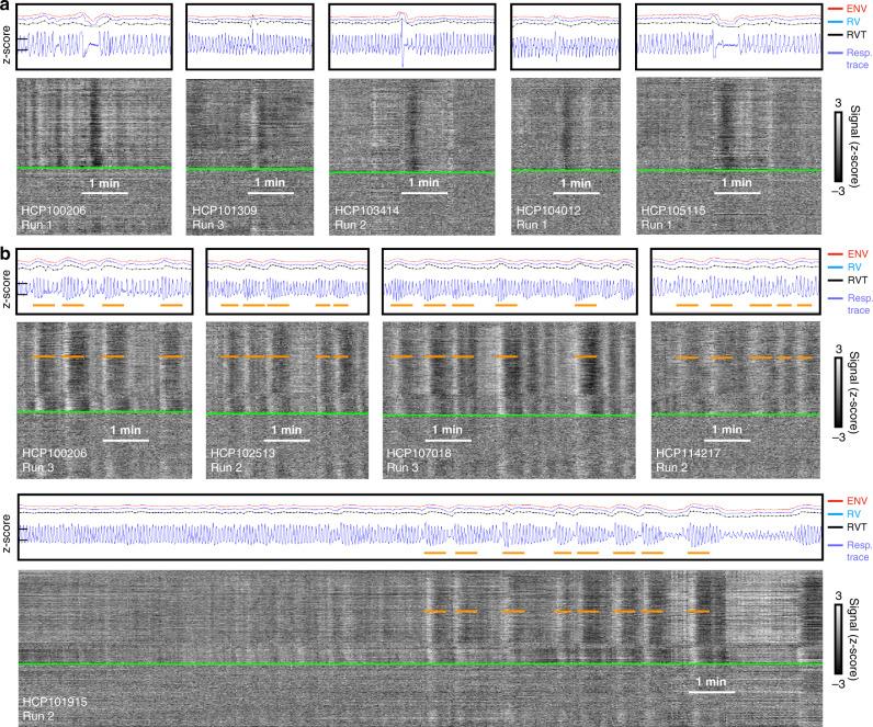 https://cdn.ncbi.nlm.nih.gov/pmc/blobs/1547/7576607/29761c0eb637/41467_2020_18974_Fig2_HTML.jpg