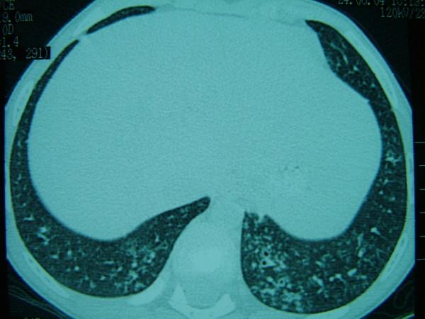 https://cdn.ncbi.nlm.nih.gov/pmc/blobs/154b/2783121/9bdd5eec0fa2/1757-1626-2-165-2.jpg