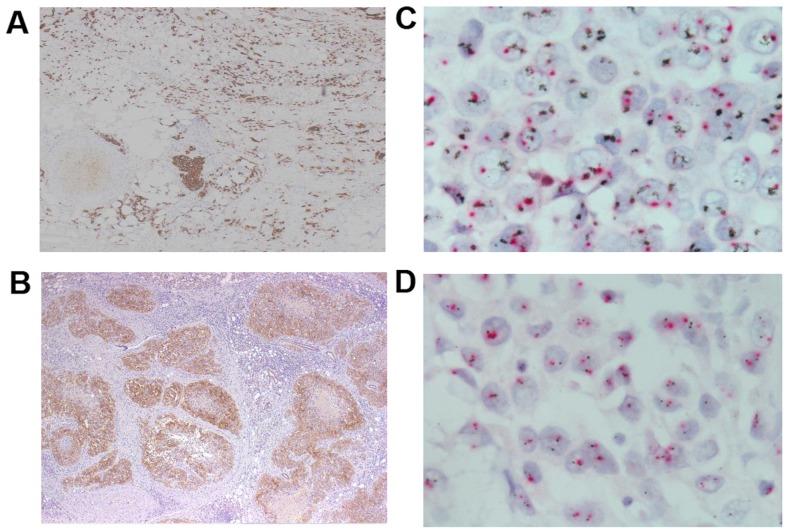 https://cdn.ncbi.nlm.nih.gov/pmc/blobs/154d/6589940/b4216ecc3799/mco-11-02-0111-g02.jpg
