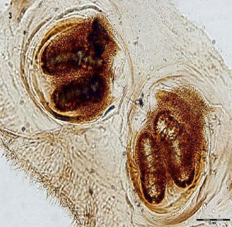 https://cdn.ncbi.nlm.nih.gov/pmc/blobs/1556/3547307/176fe064181c/jad-6-156f3.jpg