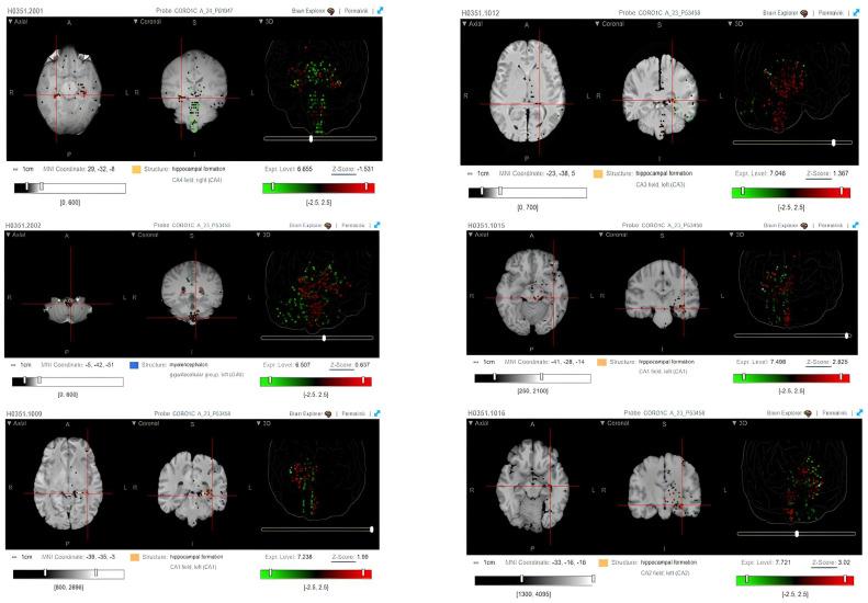 https://cdn.ncbi.nlm.nih.gov/pmc/blobs/1559/9844418/2f9edca0eee0/ncrna-09-00004-g002.jpg