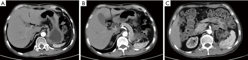 https://cdn.ncbi.nlm.nih.gov/pmc/blobs/155d/7947427/ab595a3b9f70/tau-10-02-997-f7.jpg