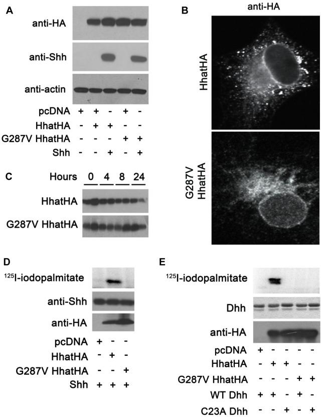 https://cdn.ncbi.nlm.nih.gov/pmc/blobs/155e/4006744/49680eb07eb5/pgen.1004340.g003.jpg