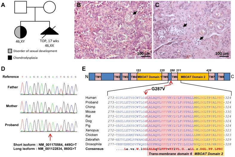 https://cdn.ncbi.nlm.nih.gov/pmc/blobs/155e/4006744/8773136a7dde/pgen.1004340.g001.jpg