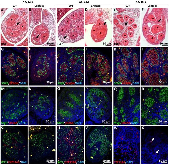 https://cdn.ncbi.nlm.nih.gov/pmc/blobs/155e/4006744/8d1c21665ff8/pgen.1004340.g004.jpg