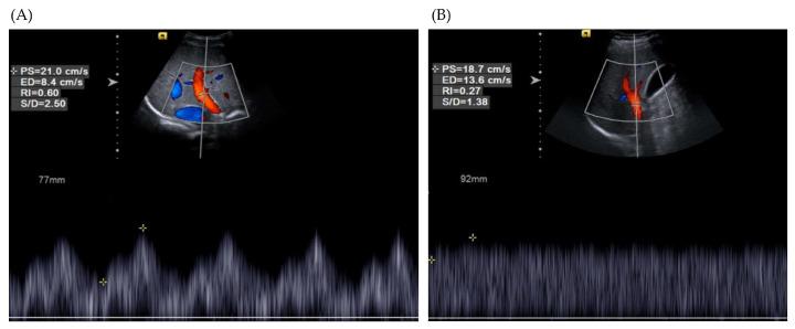 https://cdn.ncbi.nlm.nih.gov/pmc/blobs/155f/10888470/c5d38c446eea/diagnostics-14-00393-g001.jpg
