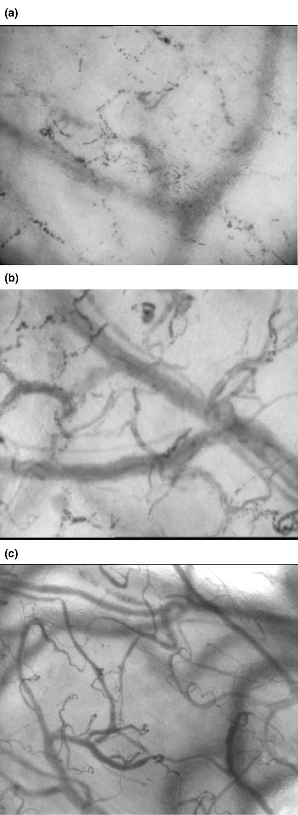 https://cdn.ncbi.nlm.nih.gov/pmc/blobs/1563/1750971/5237ef931fe7/cc4969-3.jpg