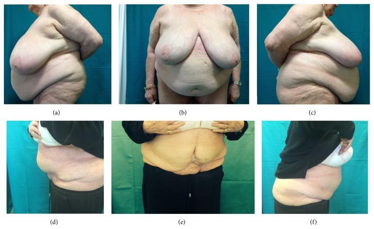 https://cdn.ncbi.nlm.nih.gov/pmc/blobs/156d/4510262/674fe5a34b89/PSI2015-209173.002.jpg