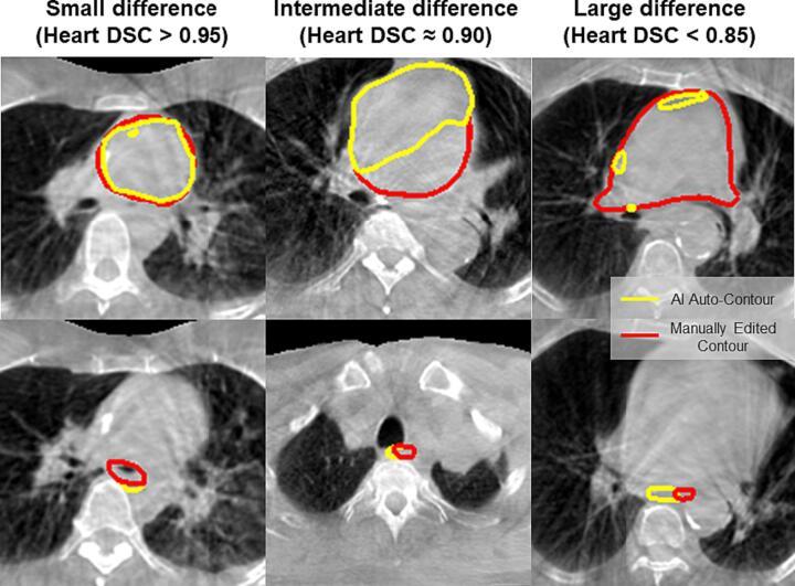 https://cdn.ncbi.nlm.nih.gov/pmc/blobs/1571/10869275/f3cec8b5d7b7/gr4.jpg