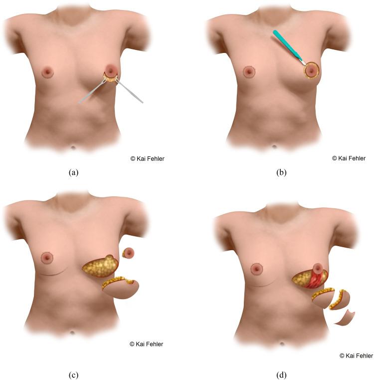 https://cdn.ncbi.nlm.nih.gov/pmc/blobs/1573/10755680/eb7a278633a4/gr2.jpg