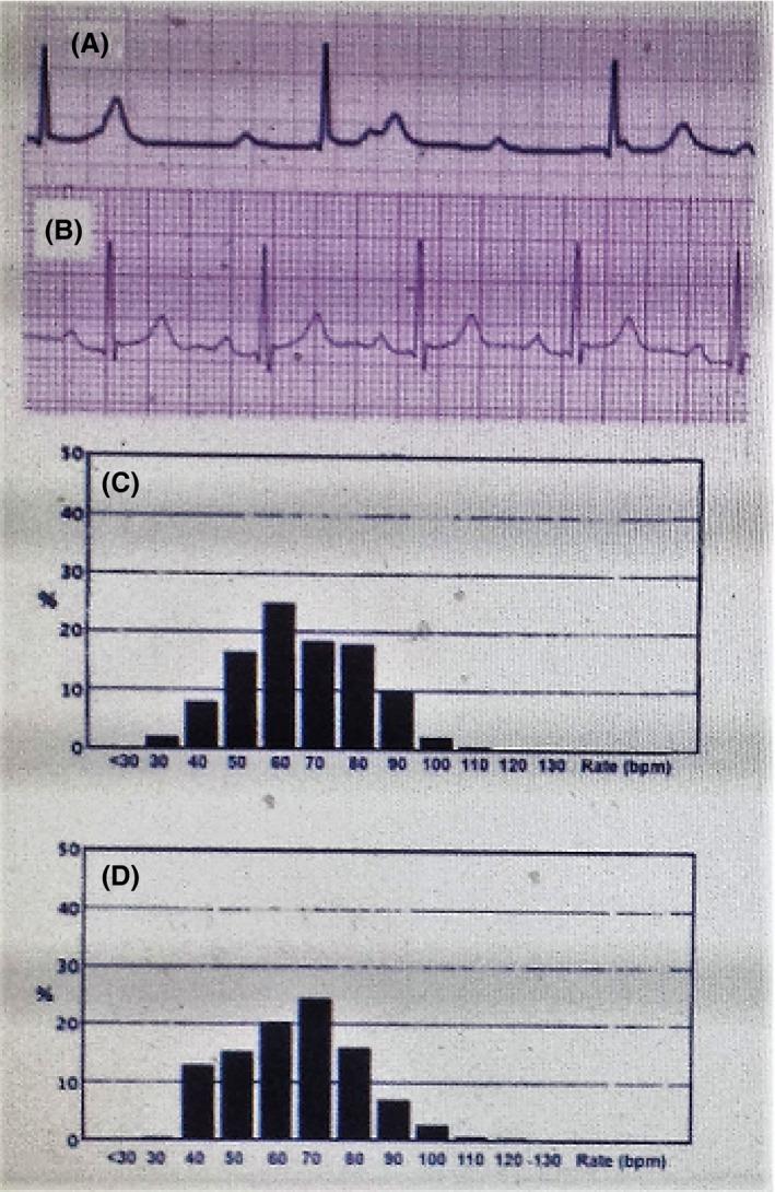 https://cdn.ncbi.nlm.nih.gov/pmc/blobs/1575/5458015/806ae5de4480/CCR3-5-915-g001.jpg