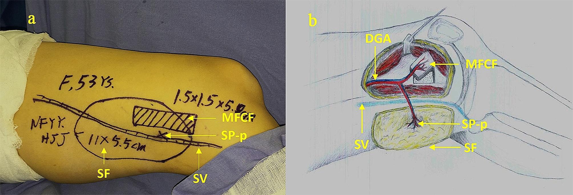 https://cdn.ncbi.nlm.nih.gov/pmc/blobs/157b/11179197/5f2ec78fea30/12893_2024_2481_Fig3_HTML.jpg