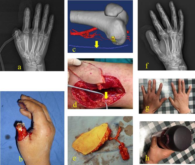 https://cdn.ncbi.nlm.nih.gov/pmc/blobs/157b/11179197/8b8ad2ce7817/12893_2024_2481_Fig5_HTML.jpg