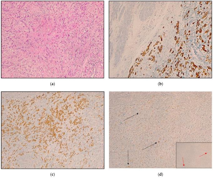 https://cdn.ncbi.nlm.nih.gov/pmc/blobs/1584/9776345/a820a87934bc/cancers-14-06023-g002.jpg