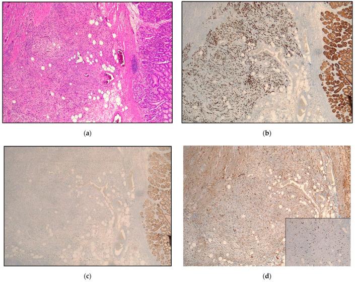 https://cdn.ncbi.nlm.nih.gov/pmc/blobs/1584/9776345/cb6d4afe6abc/cancers-14-06023-g001.jpg