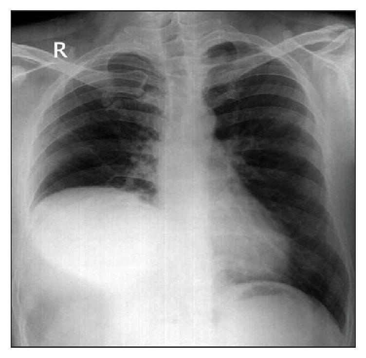 https://cdn.ncbi.nlm.nih.gov/pmc/blobs/1585/5662827/13ca056c5804/CRIPU2017-9848696.001.jpg