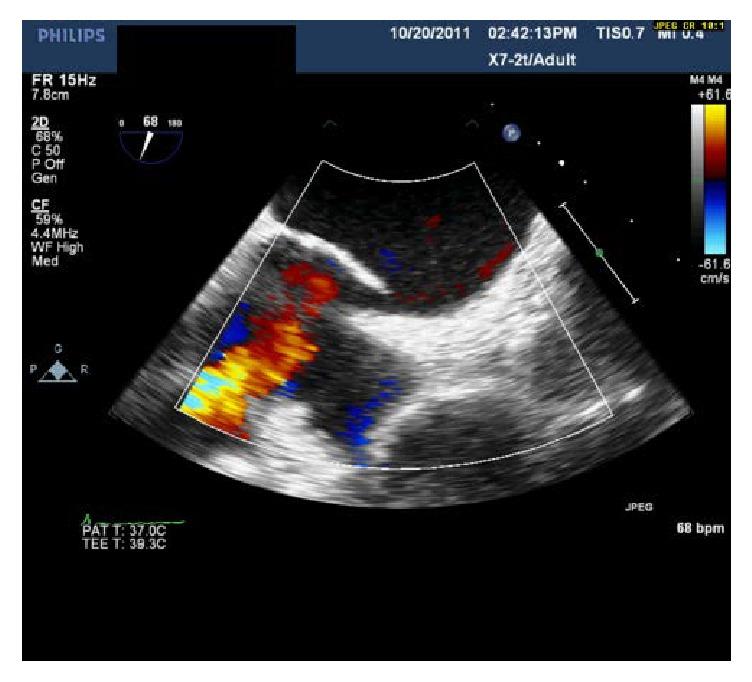 https://cdn.ncbi.nlm.nih.gov/pmc/blobs/1585/5662827/e61001be8904/CRIPU2017-9848696.002.jpg