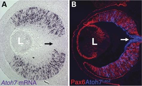 https://cdn.ncbi.nlm.nih.gov/pmc/blobs/1591/2883339/2af9fe67f9f9/ddq14404.jpg