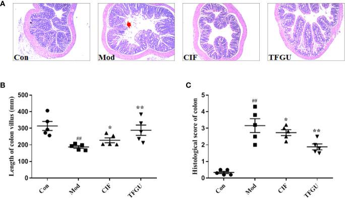 https://cdn.ncbi.nlm.nih.gov/pmc/blobs/1591/8138048/5e7757b55113/fimmu-12-628358-g002.jpg