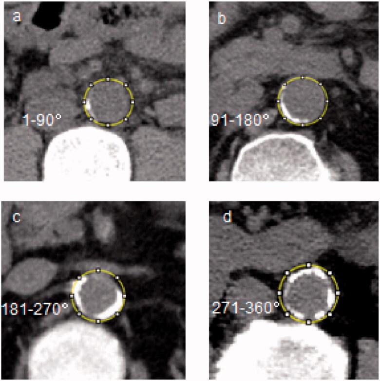 https://cdn.ncbi.nlm.nih.gov/pmc/blobs/1594/8143601/bf961abf653e/IRNF_A_1918163_F0002_C.jpg