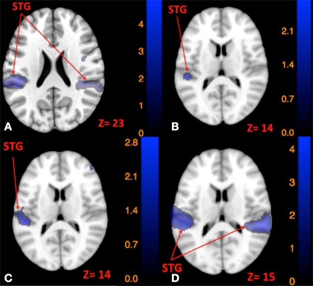 https://cdn.ncbi.nlm.nih.gov/pmc/blobs/159f/5344901/239d0aee6051/fnsys-11-00011-g0005.jpg