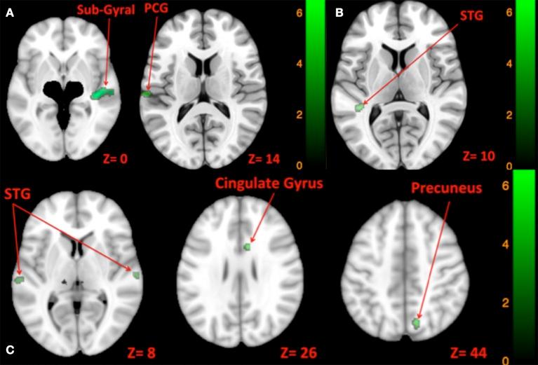 https://cdn.ncbi.nlm.nih.gov/pmc/blobs/159f/5344901/fc17e4c4ddc5/fnsys-11-00011-g0009.jpg