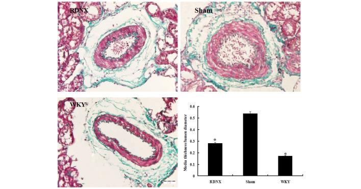 https://cdn.ncbi.nlm.nih.gov/pmc/blobs/15a2/5038203/e6bc090a4f80/etm-12-04-2547-g02.jpg