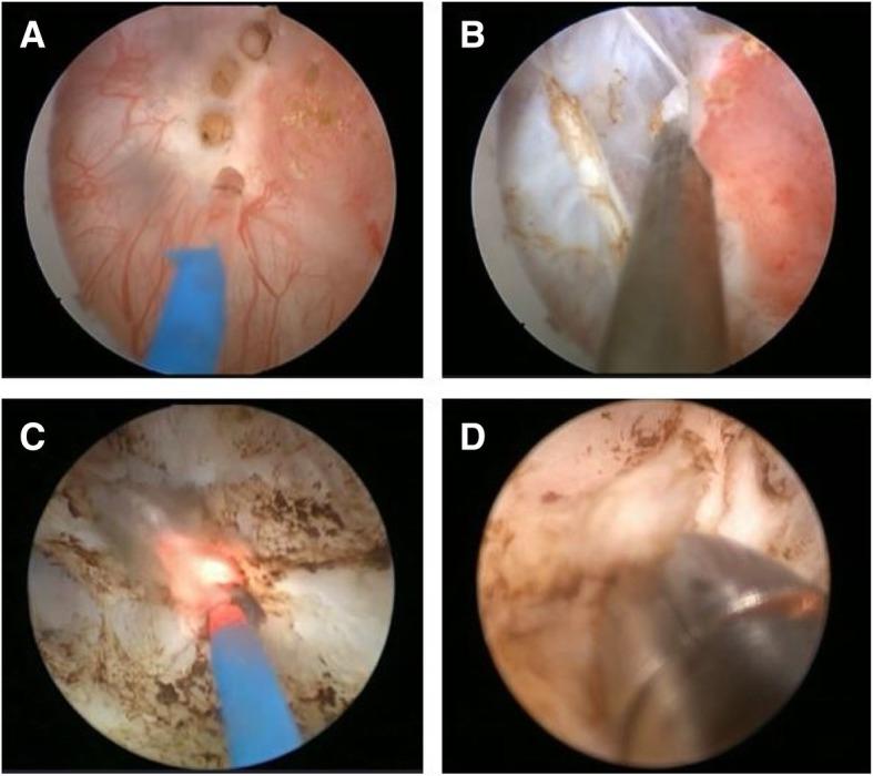https://cdn.ncbi.nlm.nih.gov/pmc/blobs/15a2/7081553/16958c1019f4/12894_2020_599_Fig1_HTML.jpg