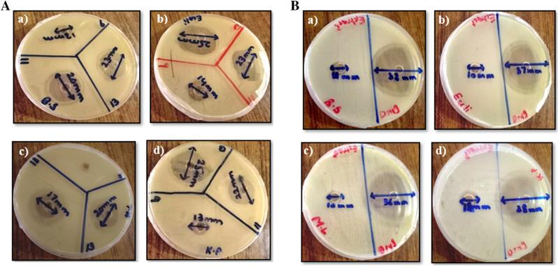 https://cdn.ncbi.nlm.nih.gov/pmc/blobs/15a4/8586337/d5f9c6aa3057/41598_2021_1374_Fig5_HTML.jpg