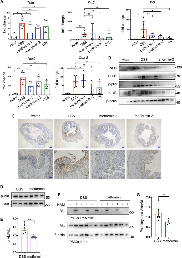 https://cdn.ncbi.nlm.nih.gov/pmc/blobs/15a7/8511025/b1c7faef9576/41419_2021_4235_Fig8_HTML.jpg