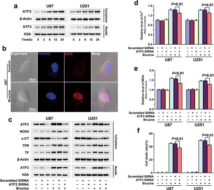 https://cdn.ncbi.nlm.nih.gov/pmc/blobs/15aa/8463534/5ed98e63ff24/41401_2021_700_Fig3_HTML.jpg