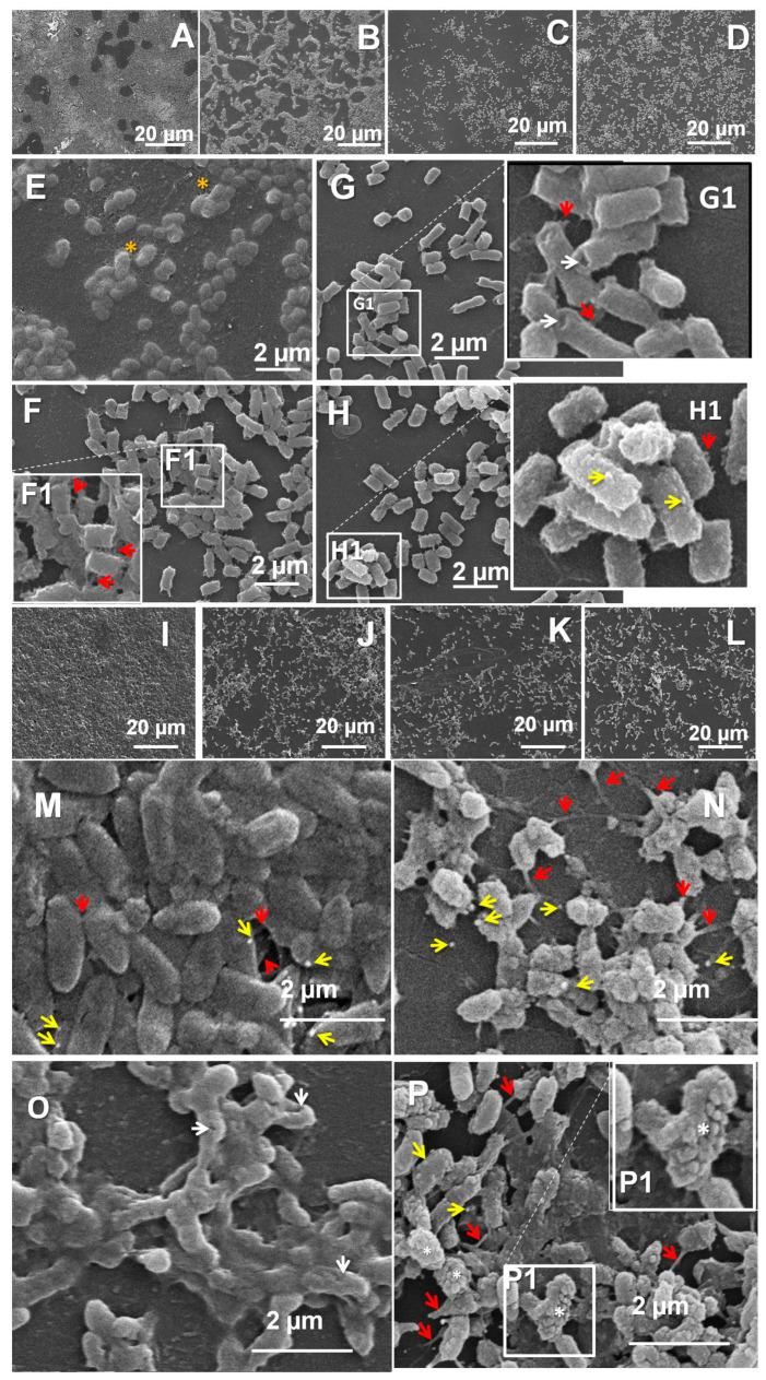 https://cdn.ncbi.nlm.nih.gov/pmc/blobs/15af/11728461/127cbd416c35/microorganisms-12-02670-g009.jpg