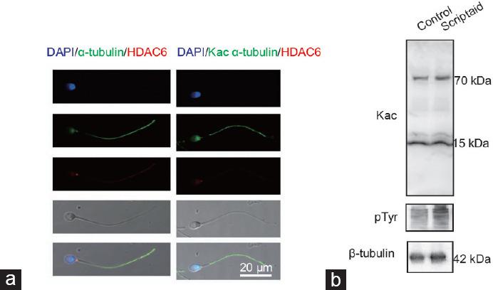 https://cdn.ncbi.nlm.nih.gov/pmc/blobs/15b4/11449406/538fe62317ec/AJA-26-490-g004.jpg