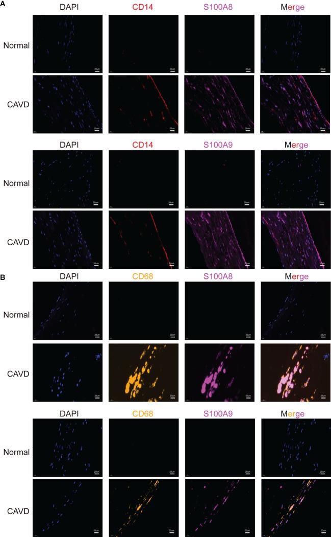 https://cdn.ncbi.nlm.nih.gov/pmc/blobs/15b5/9673246/7739515094f0/fimmu-13-1035285-g013.jpg