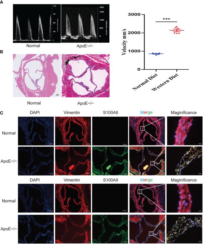 https://cdn.ncbi.nlm.nih.gov/pmc/blobs/15b5/9673246/cdb2fe1e3c4a/fimmu-13-1035285-g011.jpg