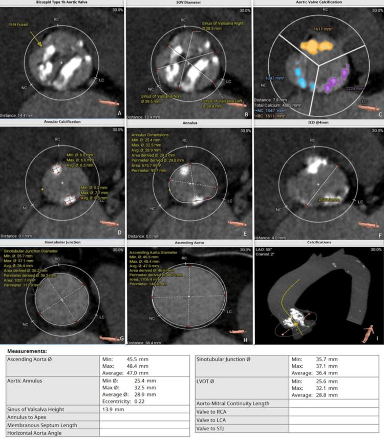 https://cdn.ncbi.nlm.nih.gov/pmc/blobs/15b9/11750050/5384326c7b14/cureus-0016-00000076195-i01.jpg