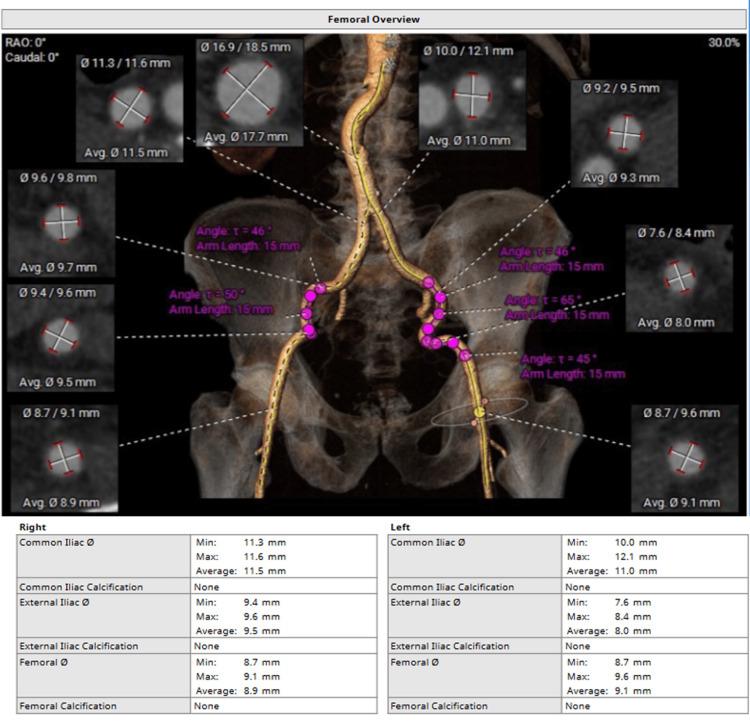 https://cdn.ncbi.nlm.nih.gov/pmc/blobs/15b9/11750050/c77e28233c67/cureus-0016-00000076195-i02.jpg