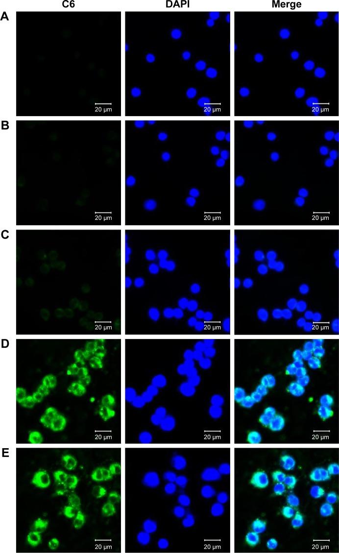 https://cdn.ncbi.nlm.nih.gov/pmc/blobs/15c5/5328661/df72ee74eac6/ijn-12-1485Fig6.jpg