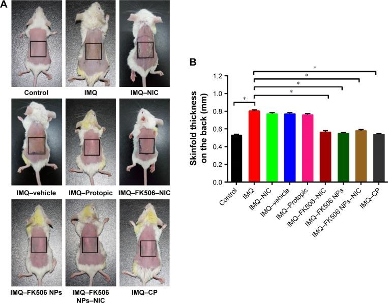 https://cdn.ncbi.nlm.nih.gov/pmc/blobs/15c5/5328661/e75ba8aca425/ijn-12-1485Fig3.jpg
